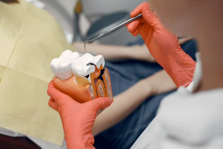 shielding your smile: a guide to preventing cavities
